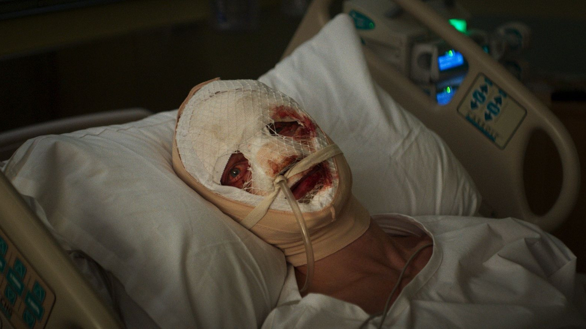 Matt Hagen a l'hopital dans Clayface